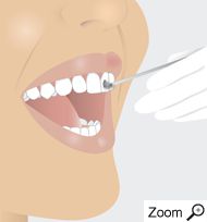 Fluorid schützt die Zähne nachhaltig